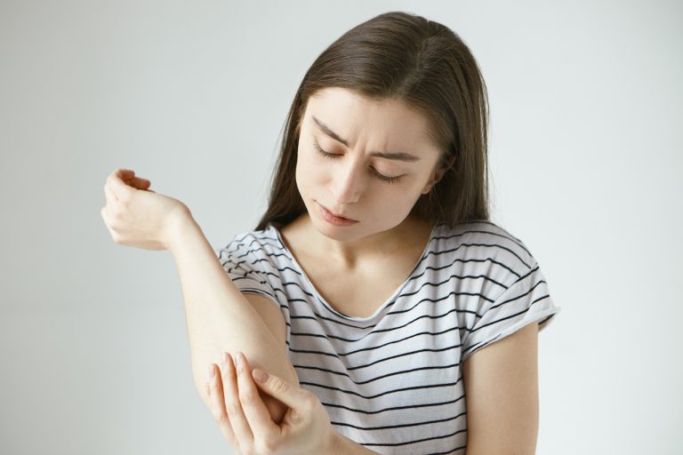 Studio Picture Of Frustrated Young Dark Haired Female Studying Skin On Her Arm After She Fell Off Bike. Student Girl Dressed In Stylish Striped T Shirt Looking At Her Elbow, Feeling Itch Or Pain